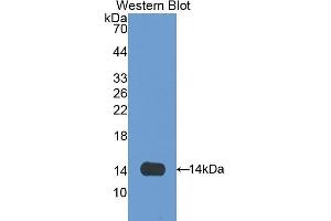 Western Blotting (WB) image for anti-Olfactomedin 4 (OLFM4) (AA 405-511) antibody (ABIN1172486) (Olfactomedin 4 antibody  (AA 405-511))