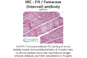 Image no. 2 for anti-Fumarate Hydratase (FH) (Internal Region) antibody (ABIN1734346) (FH antibody  (Internal Region))