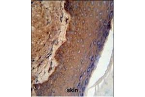 KRT9 Antibody (Center ) (ABIN652316 and ABIN2841447) IHC analysis in formalin fixed and paraffin embedded skin tissue followed by peroxidase conjugation of the secondary antibody and DAB staining. (KRT9 antibody  (AA 302-331))