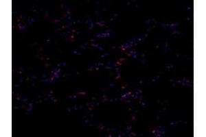 Immunofluorescent analysis of paraformaldehyde-fixed human para-cancer lung using PNN (ABIN7075083) at dilution of 1: 800 (PNN antibody)