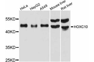 Western blot analysis of extracts of various cell lines, using HOXC10 antibody (ABIN6291152) at 1:1000 dilution. (HOXC10 antibody)