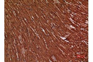 Immunohistochemistry (IHC) analysis of paraffin-embedded Mouse Heart, antibody was diluted at 1:100. (Troponin Complex T-C (Internal Region) antibody)