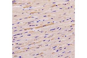 Immunohistochemistry (Paraffin-embedded Sections) (IHC (p)) image for anti-Endonuclease VIII-Like 1 (NEIL1) antibody (ABIN7073820)