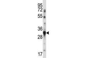 BAFF antibody western blot analysis in MDA-MB231 lysate. (BAFF antibody  (AA 16-44))