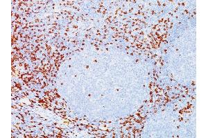 Formalin-fixed, paraffin-embedded human Tonsil stained with CD8A Mouse Monoclonal Antibody (C8/144B). (CD8 alpha antibody  (C-Term, Cytoplasmic Domain))