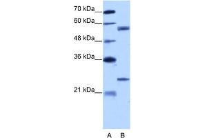 WB Suggested Anti-CPNE1 Antibody Titration:  5. (CPNE1 antibody  (N-Term))
