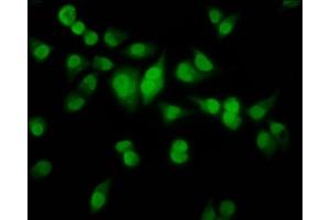 Immunofluorescence staining of Hela cells with ABIN7155703 at 1:100, counter-stained with DAPI. (HMX2 antibody  (AA 1-150))