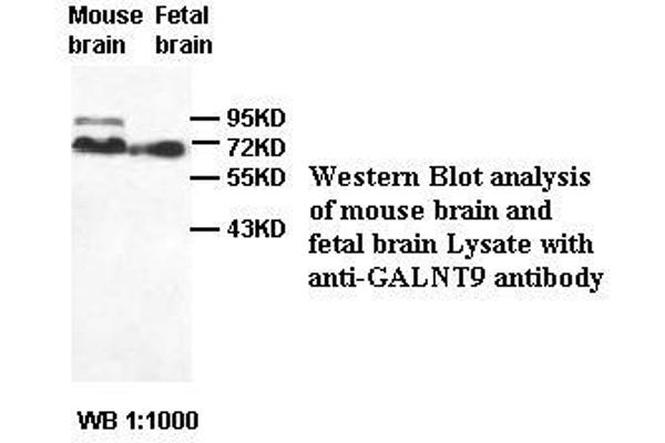 GALNT9 抗体
