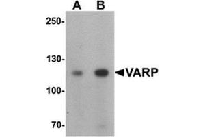Western blot analysis of VARP in K562 cell lysate with VARP Antibody  at (A) 1 and (B) 2 μg/mL. (ANKRD27 antibody  (N-Term))