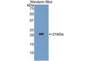 Western Blotting (WB) image for anti-Dermatopontin (DPT) (AA 26-197) antibody (ABIN1175687) (Dermatopontin antibody  (AA 26-197))