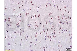 Formalin-fixed and paraffin embedded rat brain labeled with Rabbit Anti ANP32C Polyclonal Antibody, Unconjugated (ABIN759941) at 1:200 followed by conjugation to the secondary antibody and DAB staining (ANP32C antibody  (AA 81-180))
