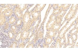Detection of TNFRSF19 in Human Kidney Tissue using Polyclonal Antibody to Tumor Necrosis Factor Receptor Superfamily, Member 19 (TNFRSF19) (TNFRSF19 antibody  (AA 35-160))
