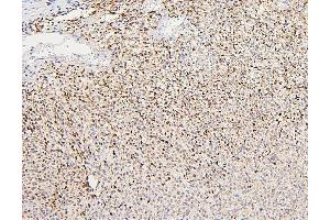 anti-Polycystic Kidney Disease 2 (Autosomal Dominant) (PKD2) (AA 829-893) antibody