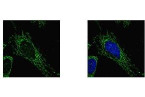 ICC/IF Image SUCLG1 antibody detects SUCLG1 protein at mitochondria by confocal immunofluorescent analysis. (SUCLG1 antibody)