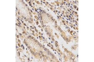 Immunohistochemistry (IHC) image for anti-Feline Sarcoma Oncogene (FES) antibody (ABIN1872678)