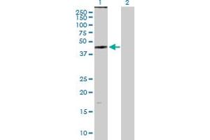 anti-Zinc Finger, DHHC-Type Containing 11 (ZDHHC11) (AA 1-412) antibody