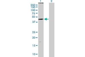 Western Blot analysis of ZDHHC11 expression in transfected 293T cell line by ZDHHC11 MaxPab polyclonal antibody. (ZDHHC11 antibody  (AA 1-412))