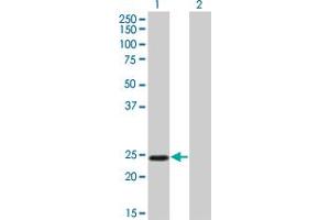 Western Blot analysis of TWIST1 expression in transfected 293T cell line by TWIST1 monoclonal antibody (M01), clone 3E11. (TWIST1 antibody  (AA 100-202))