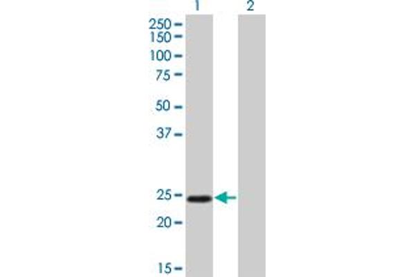 TWIST1 antibody  (AA 100-202)