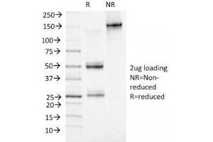 SDS-PAGE Analysis of Purified, BSA-Free MCM7 Antibody (clone MCM7/1469). (MCM7 antibody  (AA 195-319))