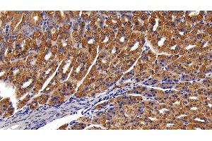 Immunohistochemistry (IHC) image for anti-Keratin 18 (KRT18) (AA 1-423) antibody (ABIN7437488)