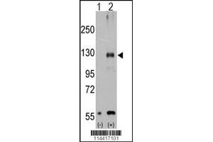 Western blot analysis of TRPM8 using rabbit polyclonal. (TRPM8 antibody  (AA 521-552))