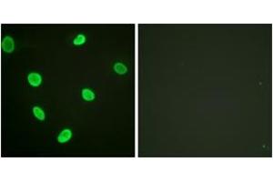 Immunofluorescence analysis of HeLa cells, using Histone H2B (Acetyl-Lys12) Antibody. (Histone H2B antibody  (acLys12))