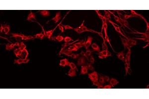 ABIN6266592 staining MDA-MB-435 by IF/ICC. (MMP15 antibody  (C-Term))