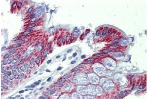 Colon, Human: Formalin-Fixed, Paraffin-Embedded (FFPE) (ACAA1 antibody  (AA 36-85))