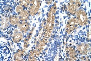 Image no. 1 for anti-Hydroxysteroid (17-Beta) Dehydrogenase 1 (HSD17B1) (N-Term) antibody (ABIN6736344) (HSD17B1 antibody  (N-Term))