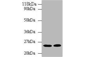 Western blot All lanes: HMGCR antibody at 2 μg/mL Lane 1: Hela whole cell lysate Lane 2: 293T whole cell lysate Secondary Goat polyclonal to rabbit IgG at 1/10000 dilution Predicted band size: 98, 93, 100 kDa Observed band size: 25 kDa (HMGCR antibody  (AA 588-887))