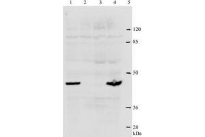 Western Blotting (WB) image for anti-Human Papilloma Virus Type 18 (HPV-18) (AA 1-83), (N-Term) antibody (ABIN781773) (HPV18 antibody  (N-Term))