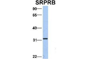 Host:  Rabbit  Target Name:  SRPRB  Sample Type:  Hela  Antibody Dilution:  1. (SRPRB antibody  (Middle Region))