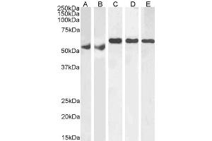 ABIN185160 (1µg/ml) staining of Human Testes (A), Human Ovary (B), Mouse Testes (C), Rat Testes (D) and Rat Ovary (E) lysate (RIPA buffer, 35µg total protein per lane). (KPNA4 antibody  (C-Term))