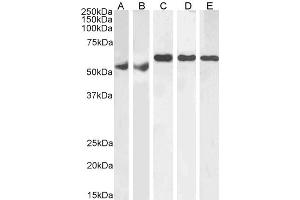 ABIN185160 (1µg/ml) staining of Human Testes (A), Human Ovary (B), Mouse Testes (C), Rat Testes (D) and Rat Ovary (E) lysate (RIPA buffer, 35µg total protein per lane). (KPNA4 antibody  (C-Term))