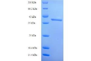 SDS-PAGE (SDS) image for Intestine-Specific Homeobox (ISX) (AA 1-245), (full length) protein (His tag) (ABIN4975693)