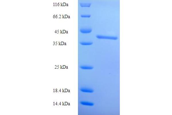 ISX Protein (AA 1-245, full length) (His tag)