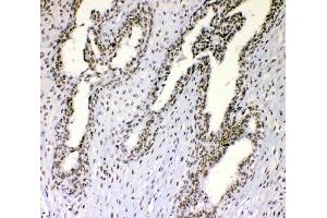 IHC analysis of nmt55/p54nrb using anti-nmt55/p54nrb antibody (ABIN3044530). (NONO antibody  (N-Term))