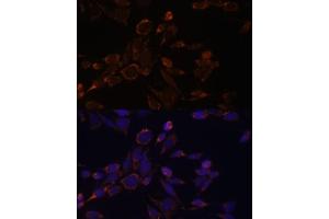 Immunofluorescence (IF) image for anti-Acetyl-CoA Acetyltransferase 1 (ACAT1) (AA 1-145) antibody (ABIN6136413)