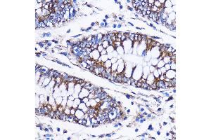 Immunohistochemistry of paraffin-embedded Human colon using IC Rabbit pAb (7500) at dilution of 1:100 (40x lens). (ICA1 antibody  (AA 1-160))