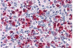 Human Spleen: Formalin-Fixed, Paraffin-Embedded (FFPE) (ARHGAP18 antibody  (C-Term))