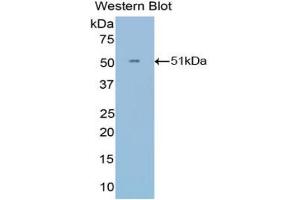 Western blot analysis of the recombinant protein. (IFNA21 antibody  (AA 25-189))