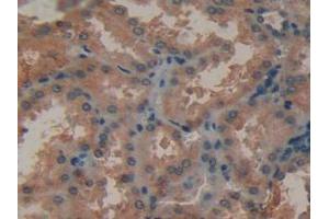 Figure. (MMP12 antibody  (AA 290-469))