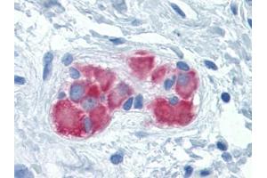 Immunohistochemistry (IHC) image for anti-Phenylalanyl-tRNA Synthetase, beta Subunit (FARSB) (AA 234-342) antibody (ABIN614697) (FARSB antibody  (AA 234-342))