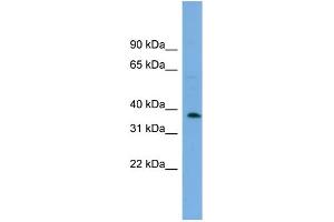 WB Suggested Anti-C17orf48 Antibody Titration: 0. (ADPRM antibody  (Middle Region))