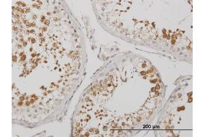 Immunoperoxidase of monoclonal antibody to BOLL on formalin-fixed paraffin-embedded human testis. (BOLL antibody  (AA 185-283))