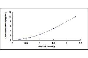 Typical standard curve (Retinoic Acid Receptor beta ELISA Kit)