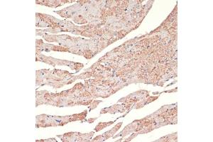 Immunohistochemistry of paraffin-embedded mouse heart using A antibody (ABIN1678588, ABIN3015506, ABIN3015508 and ABIN6218562) at dilution of 1:100 (40x lens).
