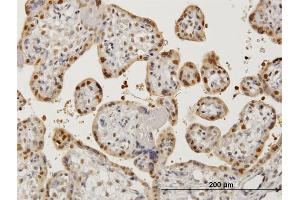 Immunoperoxidase of monoclonal antibody to AATF on formalin-fixed paraffin-embedded human placenta.