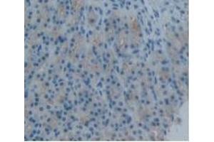 Immunohistochemistry (IHC) image for anti-Plasminogen Activator Inhibitor 2 (SERPINB2) (AA 154-408) antibody (ABIN7427369)